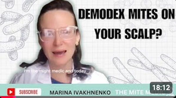 Demodex Mites & Scalp Health