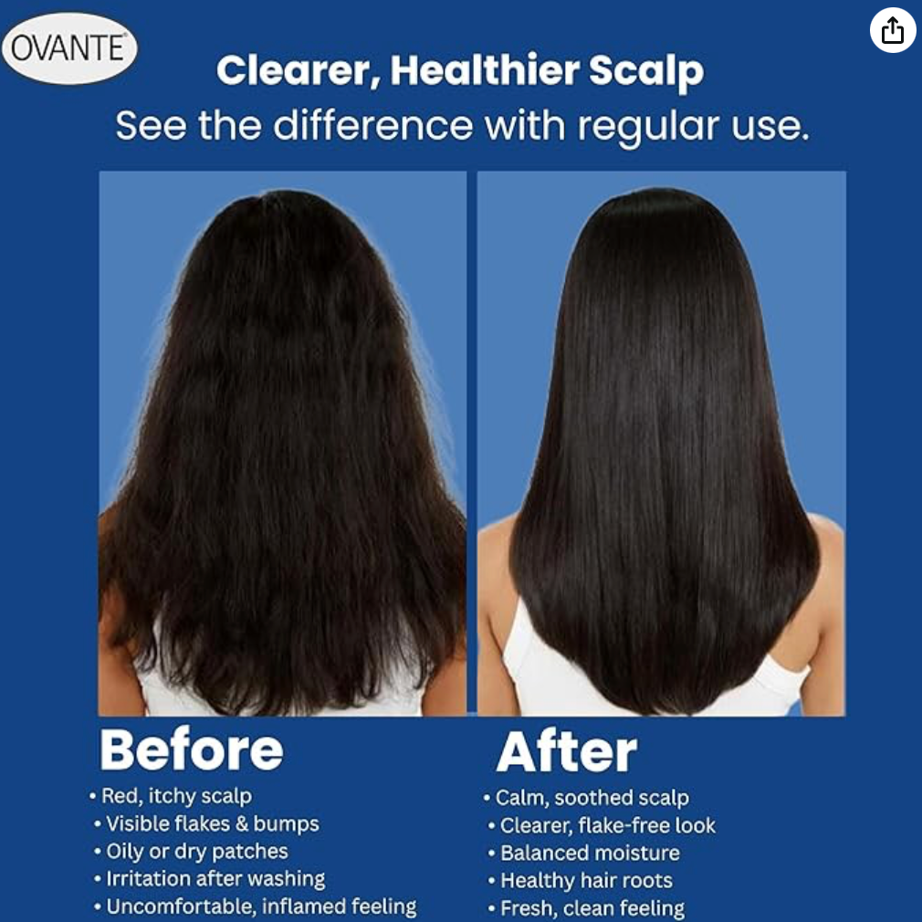 Ovante Folliculitis Shampoo | Extra Strength Anti‑Fungal, Anti‑Dandruff Treatment for Scalp Psoriasis, Itchy & Dry Scalp Relief | Dermatologist‑Reviewed Natural Herbal Formula | 8 fl oz