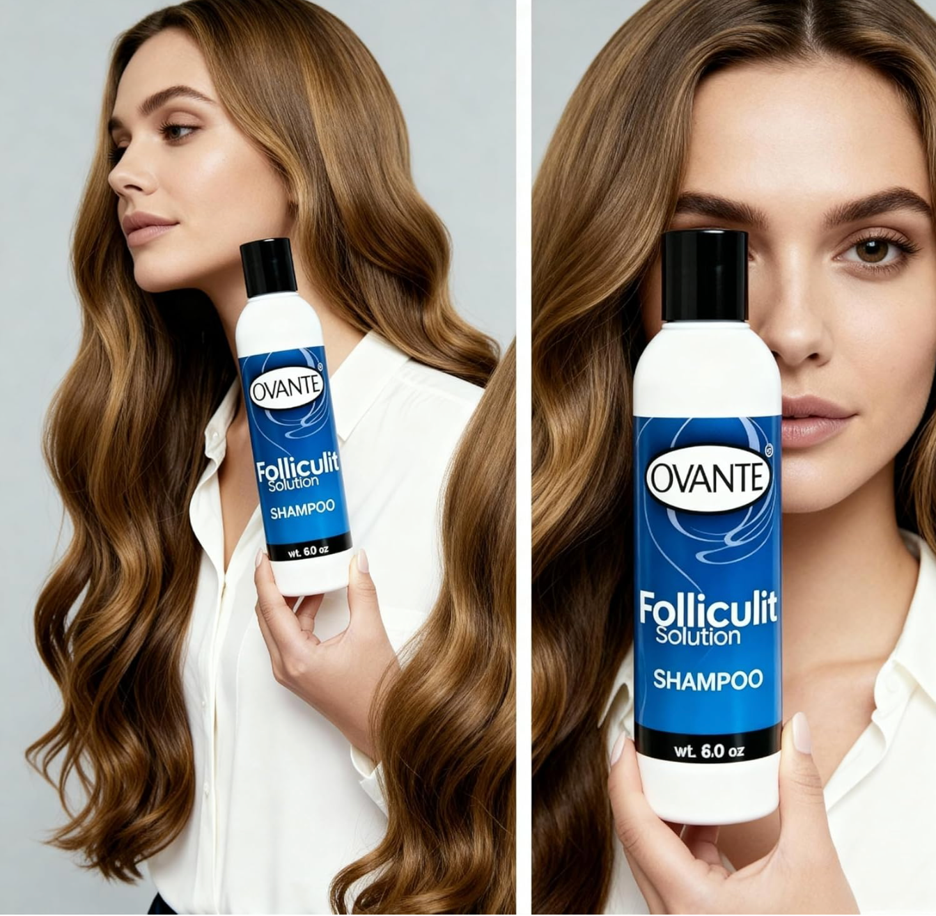 Ovante Folliculitis Shampoo | Extra Strength Anti‑Fungal, Anti‑Dandruff Treatment for Scalp Psoriasis, Itchy & Dry Scalp Relief | Dermatologist‑Reviewed Natural Herbal Formula | 8 fl oz